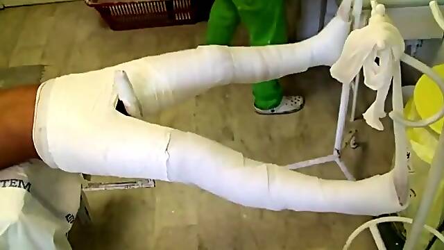 Beautiful young babe gets her sexy long legs set in cast