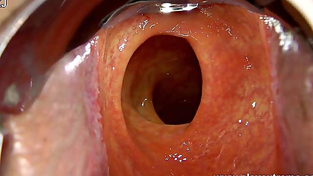 Incredible unfathomable anal view with XO speculum and light in Hotkinkyjo booty