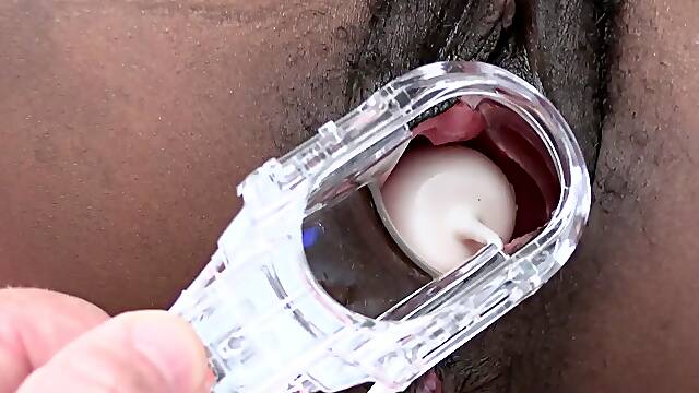 Speculum-Kegal Hairy Pussy Gaping